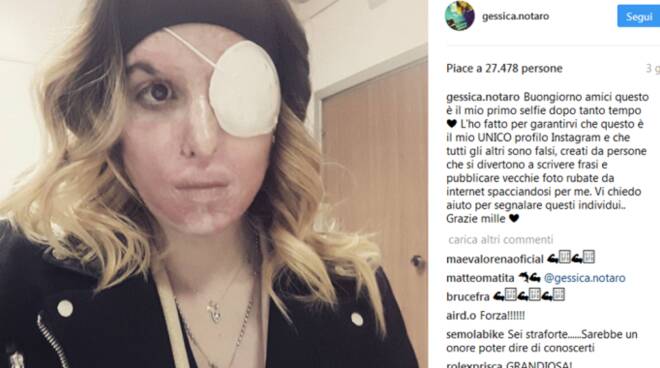 Il post di Gessica Notaro, con il selfie, su Instagram