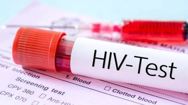 HIV