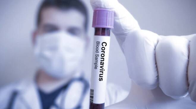 Coronavirus