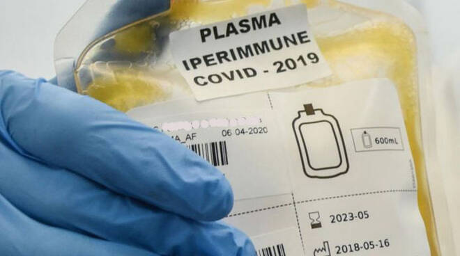 plasma iperimmune 