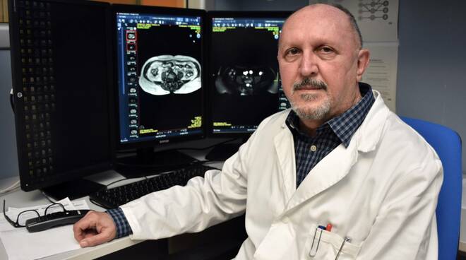 Domenico Barone - IRST Radiologia